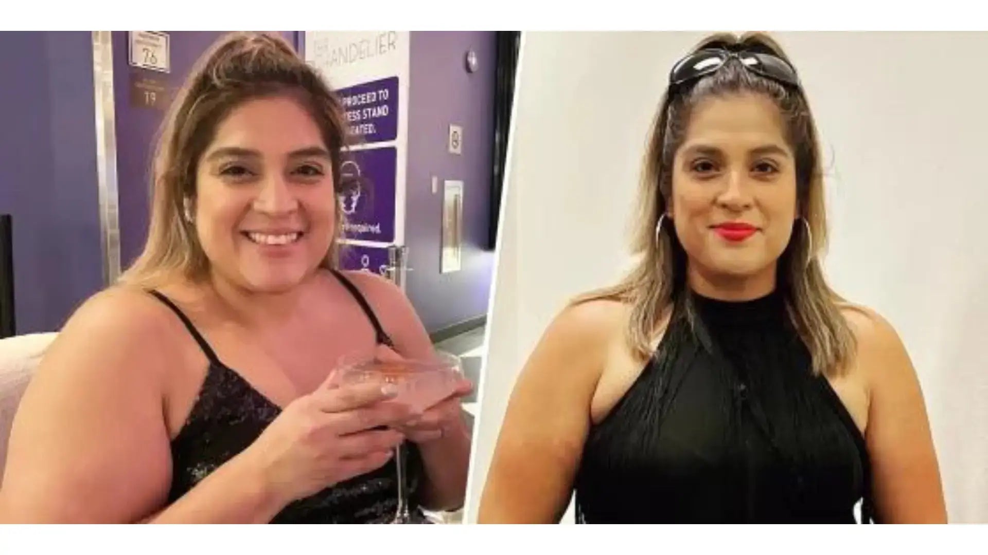 Semaglutide Before And After with Photo Examples