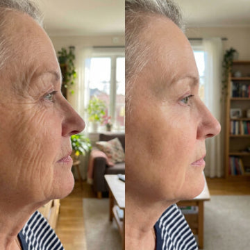 ghk-cu efekty Ghk-cu and skin peptides (topical)
