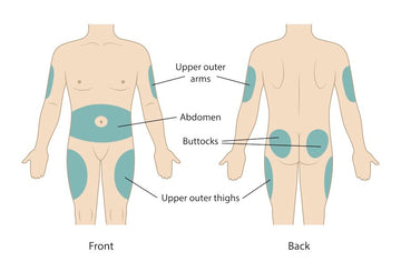 Step-by-Step Guide to Injecting GLP-1 Safely
