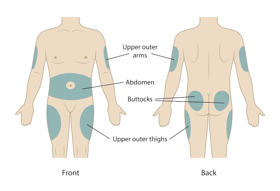 Step-by-Step Guide to Injecting GLP-1 Safely