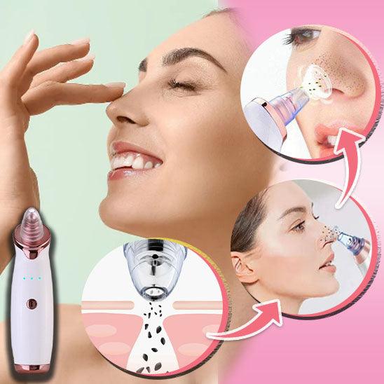 Extracteur point noir | AspiBlakhead™ - belleMbeauté